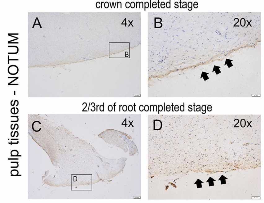 Expression of NOTUM in human pulp tissues at different developmental stages.jpg